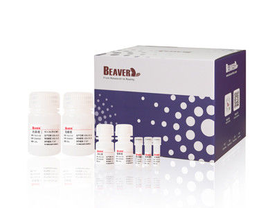 Γρήγορη μαγνητική αντίδραση BeaverBeads DEAE Magnetic Beads Προστασία πρωτεϊνών