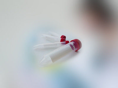 15mL κωνικός όγκος αναλωσίμων κατώτατων ιατρικός εργαστηρίων σωλήνων φυγοκεντρωτών αποστειρωμένος